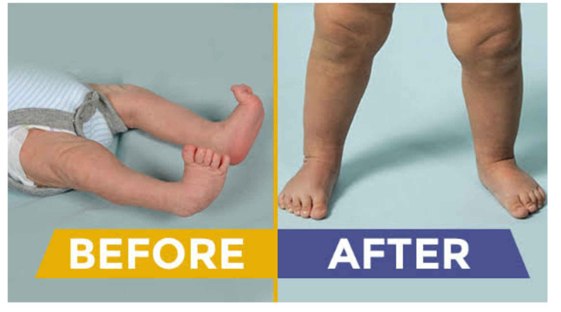 Deformity Correction Surgery